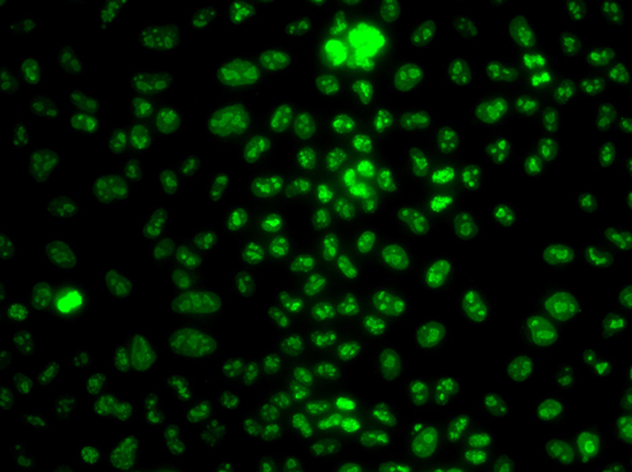 Immunofluorescence analysis of HeLa cells using Ki67 antibody (14-010) .