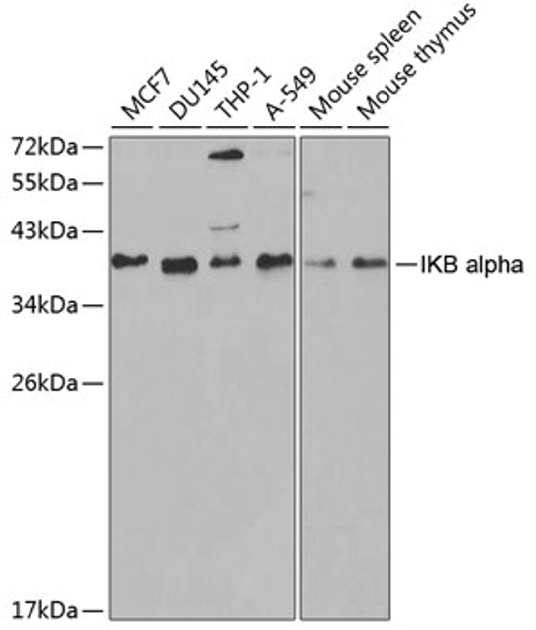 Western blot analysis of extracts of various cell lines, using IKB alpha antibody (14-011) at 1:1000 dilution.<br/>Secondary antibody: HRP Goat Anti-Rabbit IgG (H+L) at 1:10000 dilution.<br/>Lysates/proteins: 25ug per lane.<br/>Blocking buffer: 3% nonfat dry milk in TBST.