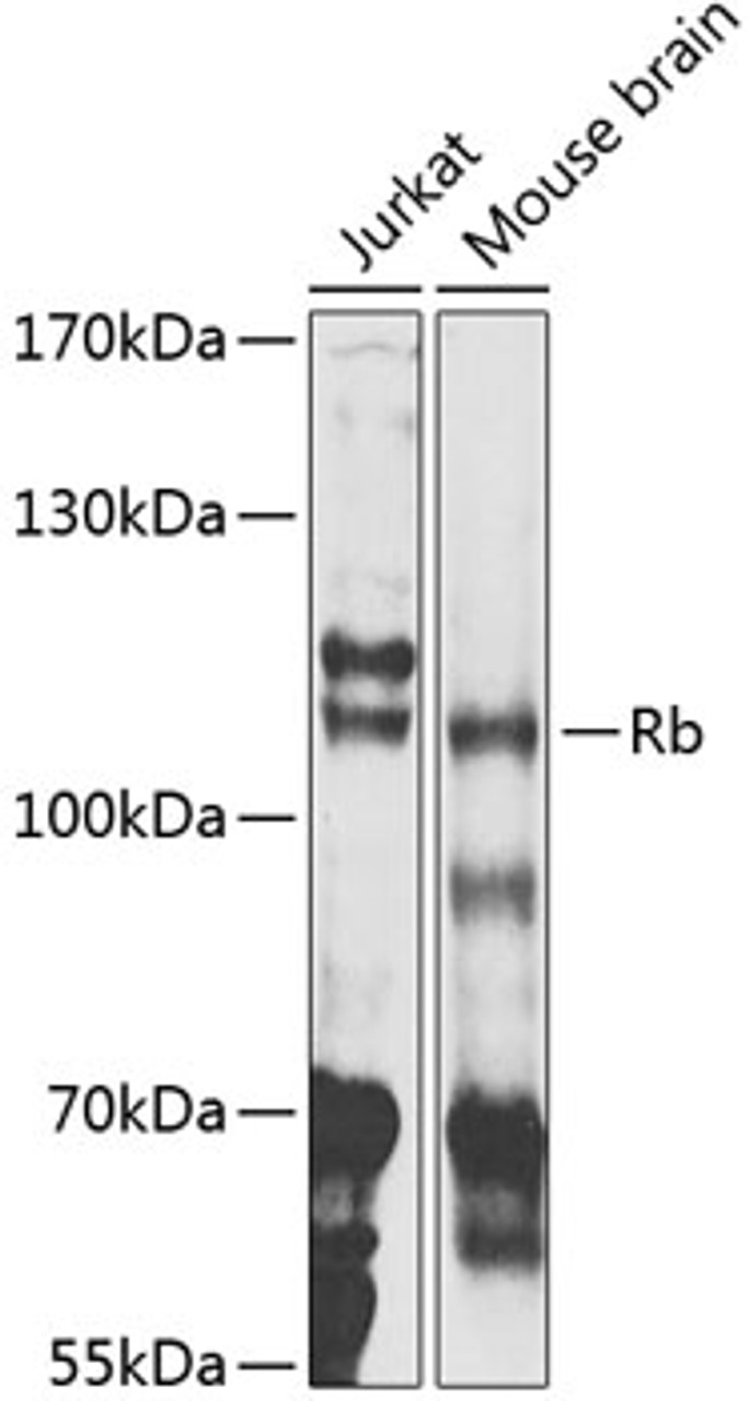 Western blot analysis of extracts of various cell lines, using Rb antibody (14-015) at 1:1000 dilution._Secondary antibody: HRP Goat Anti-Rabbit IgG (H+L) at 1:10000 dilution._Lysates/proteins: 25ug per lane._Blocking buffer: 3% nonfat dry milk in TBST._Detection: ECL Enhanced Kit._Exposure time: 90s.