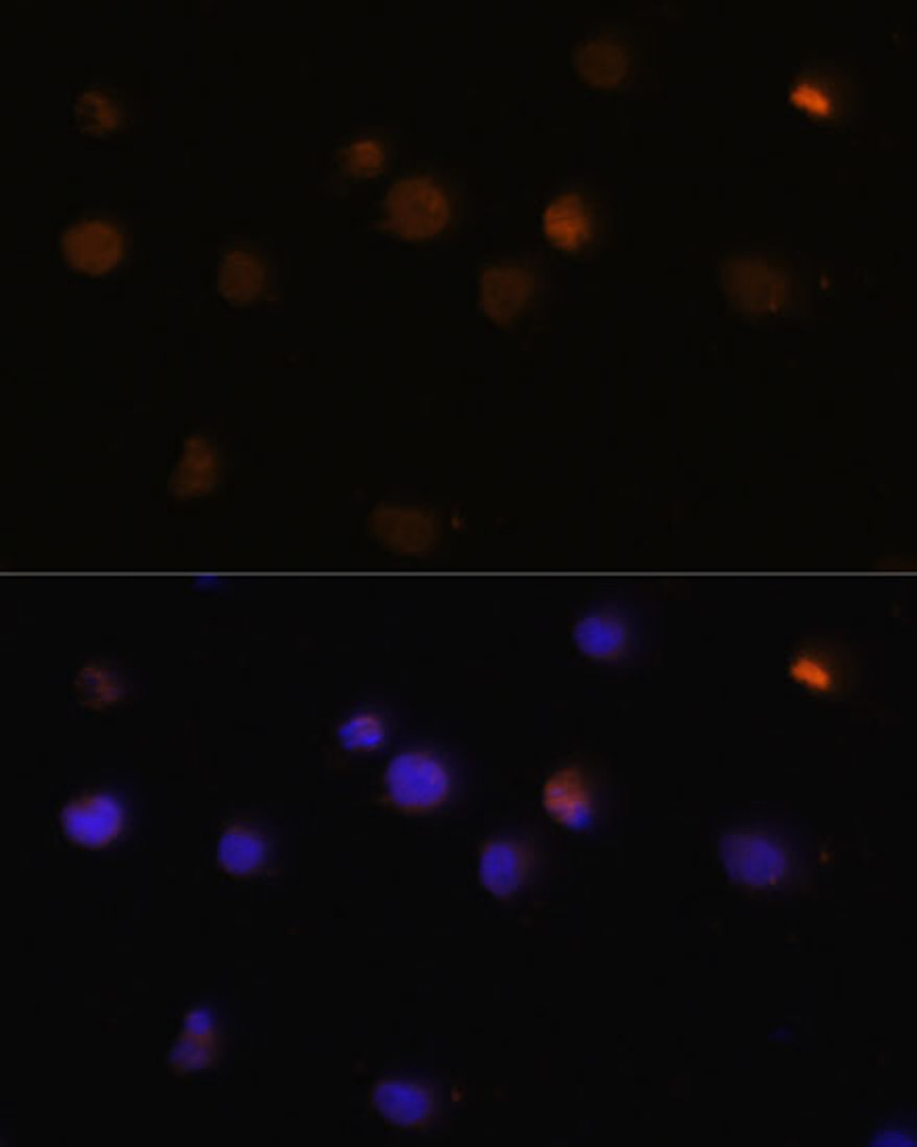 Immunofluorescence analysis of Y79 cells using Rb Polyclonal Antibody (14-015) at dilution of 1:100 (40x lens) . Blue: DAPI for nuclear staining.