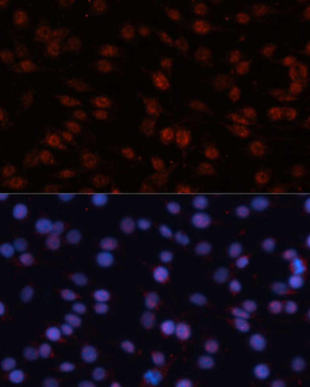 Immunofluorescence analysis of C6 cells using TCF4 Polyclonal Antibody (14-016) at dilution of 1:100 (40x lens) . Blue: DAPI for nuclear staining.