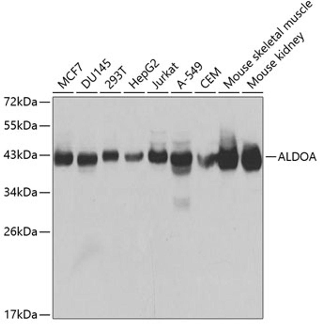 Western blot analysis of extracts of various cell lines, using ALDOA antibody (14-017) at 1:1000 dilution.<br/>Secondary antibody: HRP Goat Anti-Rabbit IgG (H+L) at 1:10000 dilution.<br/>Lysates/proteins: 25ug per lane.<br/>Blocking buffer: 3% nonfat dry milk in TBST.<br/>Detection: ECL Basic Kit.<br/>Exposure time: 2s.