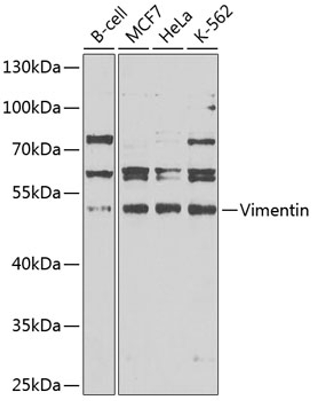 Western blot analysis of extracts of various cell lines, using Vimentin antibody (14-018) at 1:1000 dilution.<br/>Secondary antibody: HRP Goat Anti-Rabbit IgG (H+L) at 1:10000 dilution.<br/>Lysates/proteins: 25ug per lane.<br/>Blocking buffer: 3% nonfat dry milk in TBST.<br/>Detection: ECL Enhanced Kit.<br/>Exposure time: 90s.