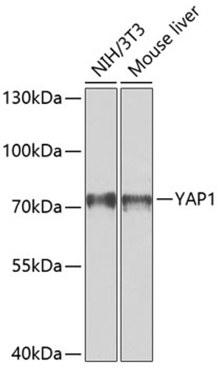 Western blot analysis of extracts of various cell lines, using YAP1 antibody (14-020) at 1:1000 dilution.<br/>Secondary antibody: HRP Goat Anti-Rabbit IgG (H+L) at 1:10000 dilution.<br/>Lysates/proteins: 25ug per lane.<br/>Blocking buffer: 3% nonfat dry milk in TBST.<br/>Detection: ECL Basic Kit.<br/>Exposure time: 90s.