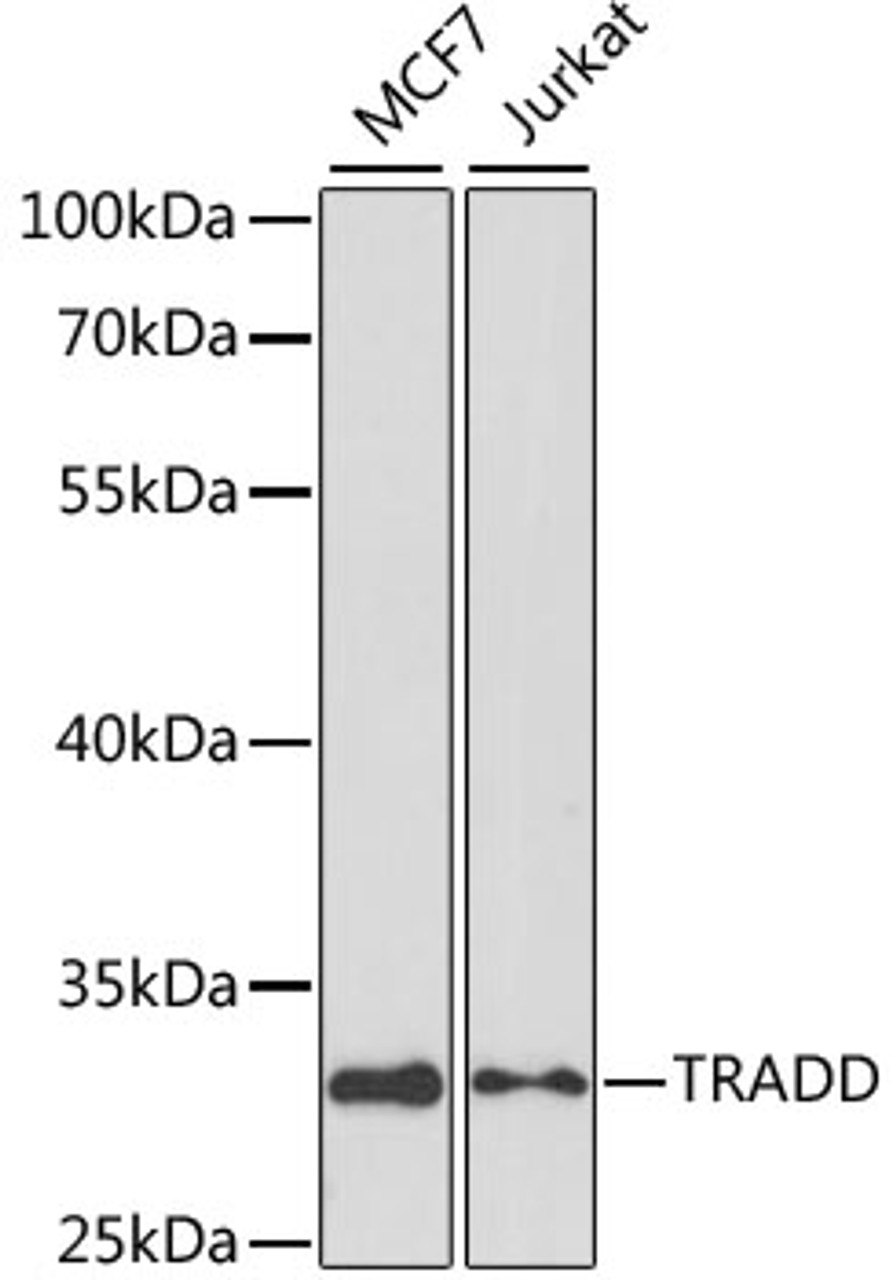 Western blot analysis of extracts of various cell lines, using TRADD antibody (14-023) at 1:1000 dilution.<br/>Secondary antibody: HRP Goat Anti-Rabbit IgG (H+L) at 1:10000 dilution.<br/>Lysates/proteins: 25ug per lane.<br/>Blocking buffer: 3% nonfat dry milk in TBST.<br/>Detection: ECL Basic Kit.<br/>Exposure time: 10s.