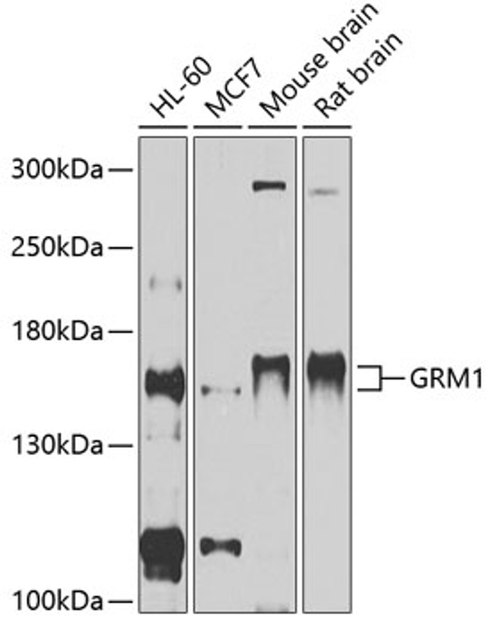 Western blot analysis of extracts of various cell lines, using GRM1 antibody (14-028) at 1:1000 dilution.<br/>Secondary antibody: HRP Goat Anti-Rabbit IgG (H+L) at 1:10000 dilution.<br/>Lysates/proteins: 25ug per lane.<br/>Blocking buffer: 3% nonfat dry milk in TBST.<br/>Detection: ECL Basic Kit.<br/>Exposure time: 1s.
