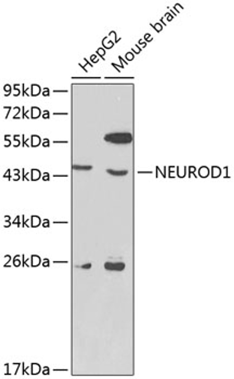 Western blot analysis of extracts of various cell lines, using NEUROD1 antibody (14-030) at 1:1000 dilution.<br/>Secondary antibody: HRP Goat Anti-Rabbit IgG (H+L) at 1:10000 dilution.<br/>Lysates/proteins: 25ug per lane.<br/>Blocking buffer: 3% nonfat dry milk in TBST.