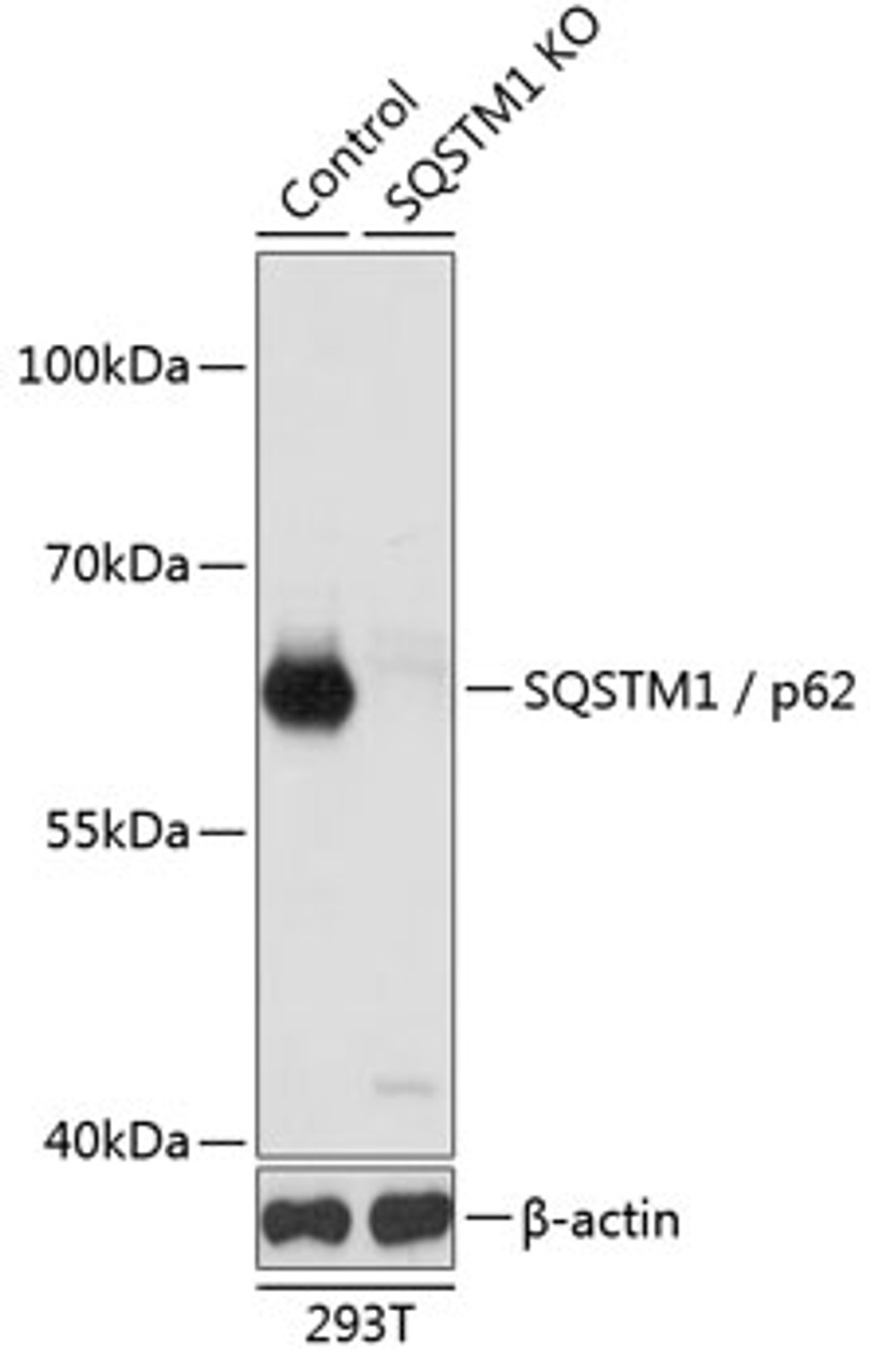 Western blot analysis of extracts from normal (control) and SQSTM1 / p62 knockout (KO) 293T cells, using SQSTM1 / p62 antibody (14-033) at 1:1000 dilution.<br/>Secondary antibody: HRP Goat Anti-Rabbit IgG (H+L) at 1:10000 dilution.<br/>Lysates/proteins: 25ug per lane.<br/>Blocking buffer: 3% nonfat dry milk in TBST.<br/>Detection: ECL Basic Kit.<br/>Exposure time: 1s.