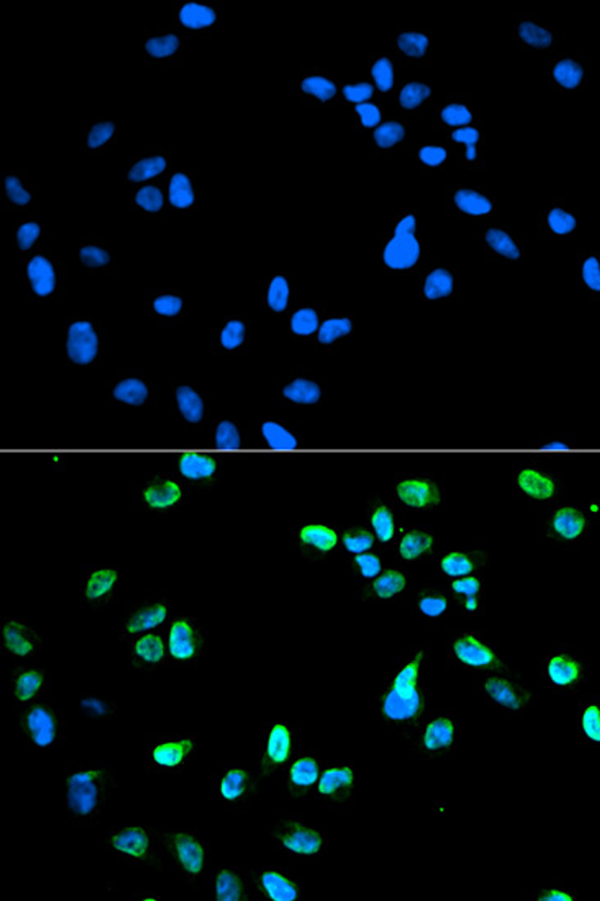 Immunofluorescence analysis of HeLa cells using IRF5 antibody (14-034) . Blue: DAPI for nuclear staining.