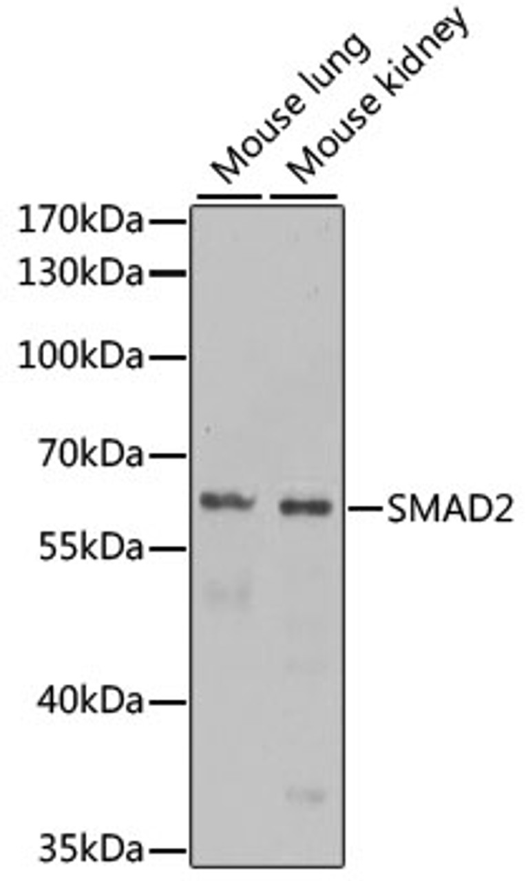 Western blot analysis of extracts of various cell lines, using SMAD2 antibody (14-036) at 1:1000 dilution.<br/>Secondary antibody: HRP Goat Anti-Rabbit IgG (H+L) at 1:10000 dilution.<br/>Lysates/proteins: 25ug per lane.<br/>Blocking buffer: 3% nonfat dry milk in TBST.<br/>Detection: ECL Enhanced Kit.<br/>Exposure time: 60s.