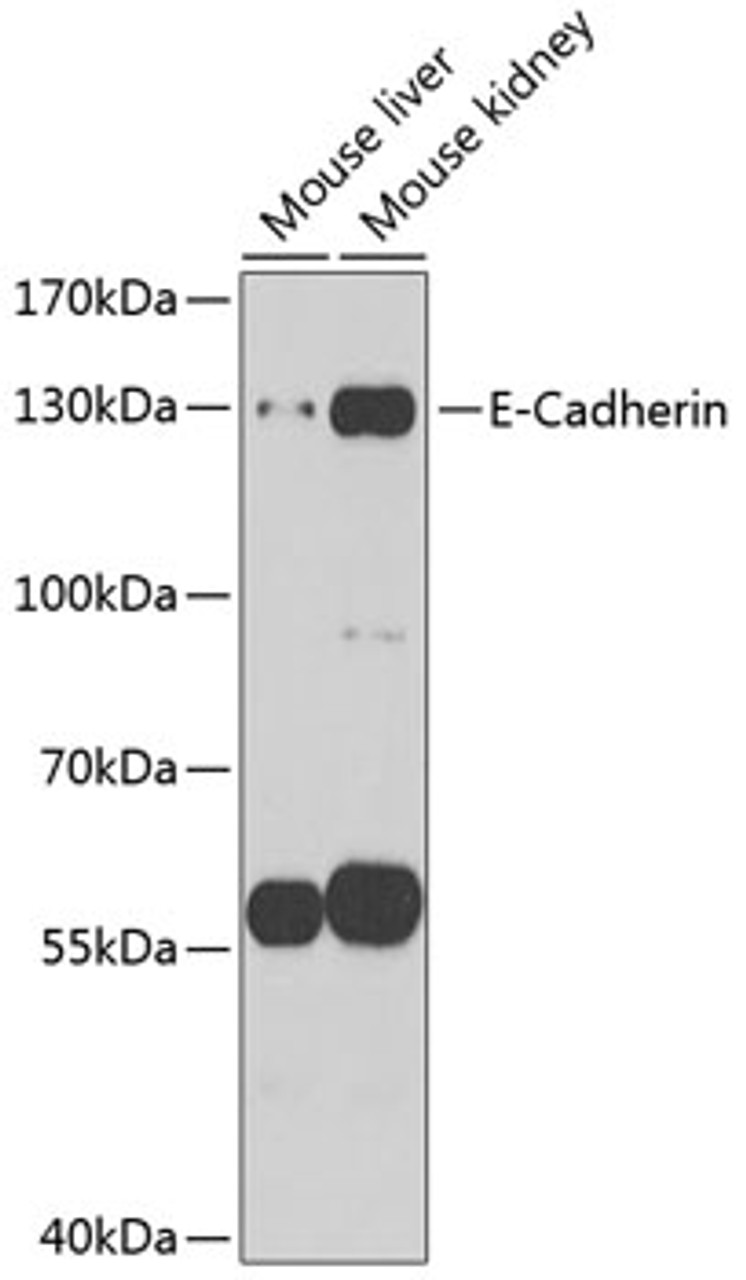 Western blot analysis of extracts of various cell lines, using E-Cadherin antibody (14-037) at 1:1000 dilution.<br/>Secondary antibody: HRP Goat Anti-Rabbit IgG (H+L) at 1:10000 dilution.<br/>Lysates/proteins: 25ug per lane.<br/>Blocking buffer: 3% nonfat dry milk in TBST.<br/>Detection: ECL Enhanced Kit.<br/>Exposure time: 60s.