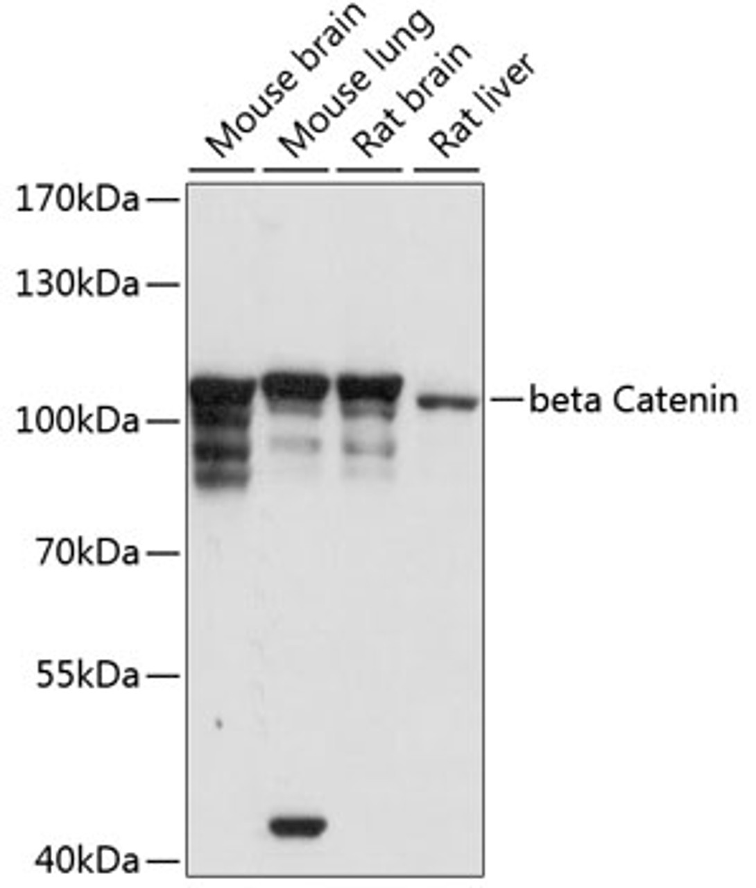 Western blot analysis of extracts of various cell lines, using beta Catenin antibody (14-039) at 1:3000 dilution.<br/>Secondary antibody: HRP Goat Anti-Rabbit IgG (H+L) at 1:10000 dilution.<br/>Lysates/proteins: 25ug per lane.<br/>Blocking buffer: 3% nonfat dry milk in TBST.<br/>Detection: ECL Basic Kit.<br/>Exposure time: 1s.