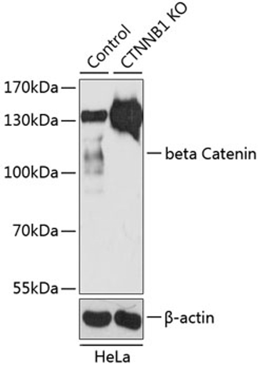 Western blot analysis of extracts from normal (control) and beta Catenin knockout (KO) HeLa cells, using beta Catenin antibody (14-039) at 1:500 dilution.<br/>Secondary antibody: HRP Goat Anti-Rabbit IgG (H+L) at 1:10000 dilution.<br/>Lysates/proteins: 25ug per lane.<br/>Blocking buffer: 3% nonfat dry milk in TBST.<br/>Detection: ECL Basic Kit.<br/>Exposure time: 30s.