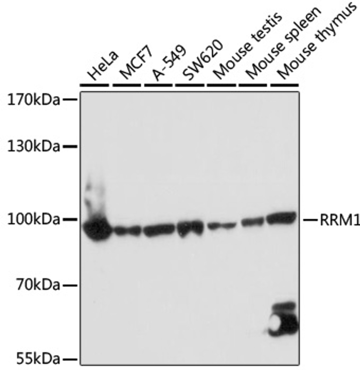 Immunohistochemistry of paraffin-embedded human prostate using RRM1 antibody (14-040) at dilution of 1:200 (40x lens) .