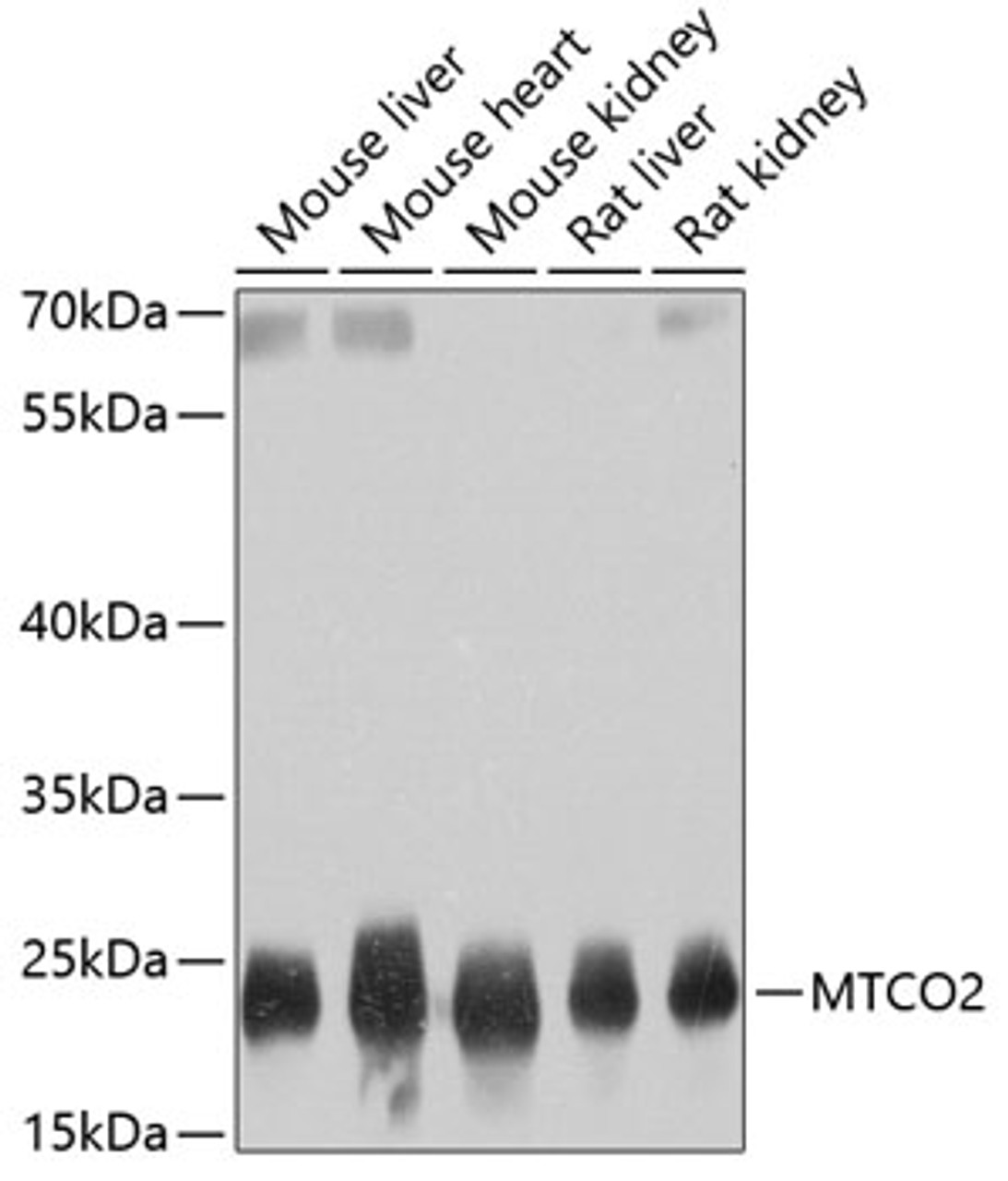 Western blot analysis of extracts of various cell lines, using MTCO2 antibody (14-041) at 1:800 dilution.<br/>Secondary antibody: HRP Goat Anti-Rabbit IgG (H+L) at 1:10000 dilution.<br/>Lysates/proteins: 25ug per lane.<br/>Blocking buffer: 3% nonfat dry milk in TBST.<br/>Detection: ECL Basic Kit.<br/>Exposure time: 1s.