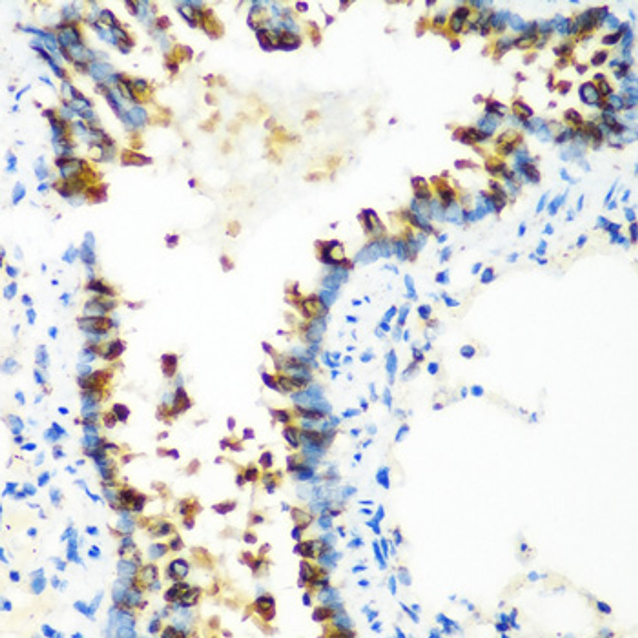 Immunohistochemistry of paraffin-embedded rat lung using MTCO2 antibody (14-041) at dilution of 1:100 (40x lens) .