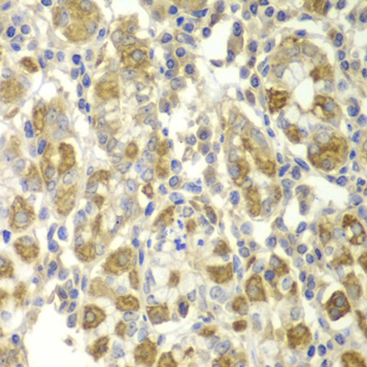 Immunohistochemistry of paraffin-embedded human stomach using TNF-α antibody (14-045) at dilution of 1:100 (40x lens) .