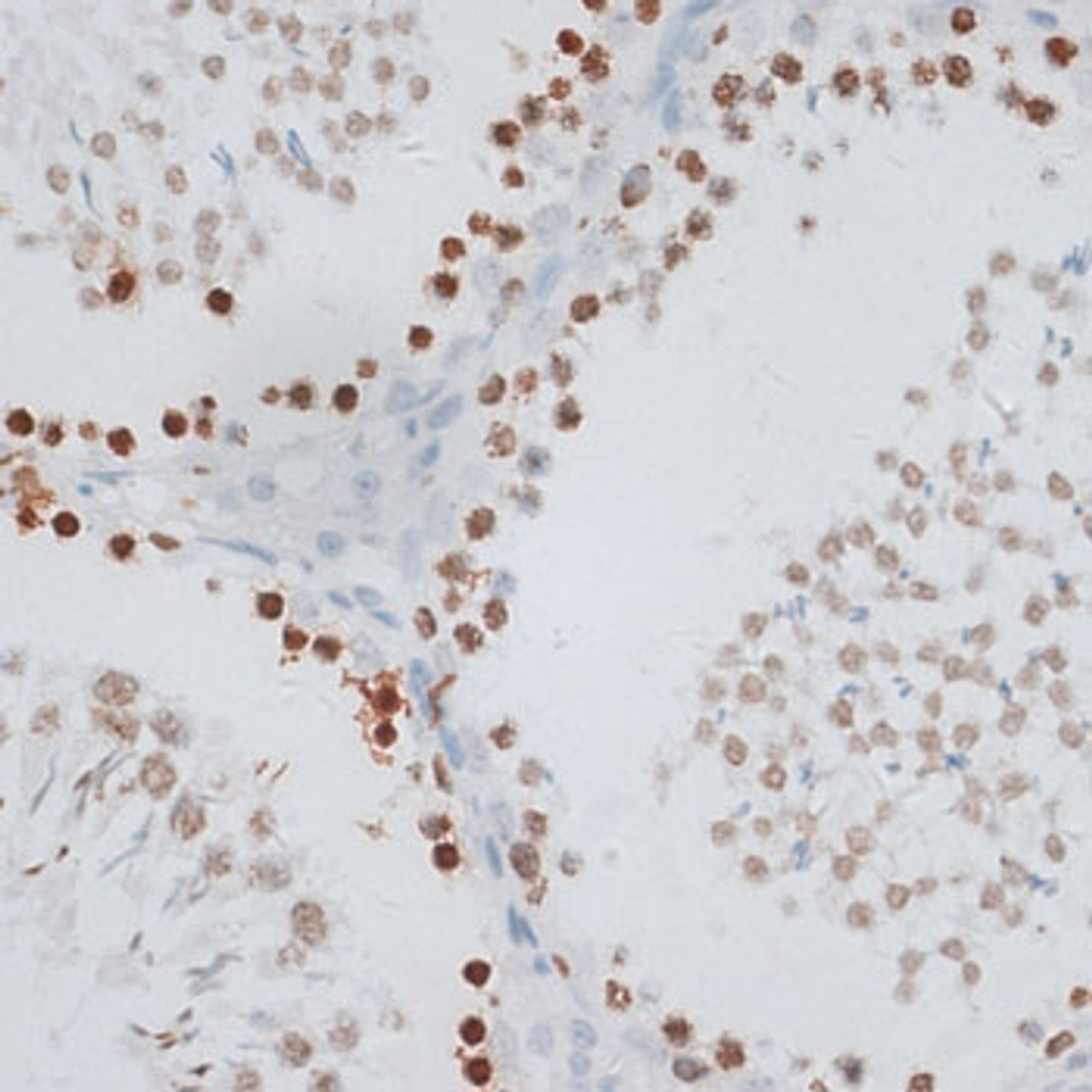 Immunohistochemistry of paraffin-embedded rat testis using Histone H2AX antibody (14-047) at dilution of 1:100 (40x lens) .