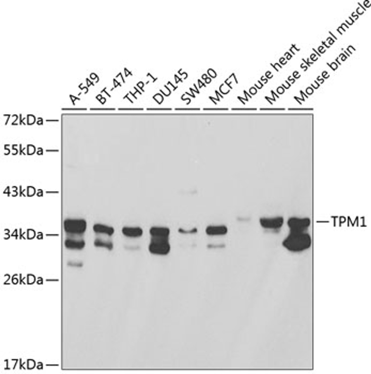Western blot analysis of extracts of various cell lines, using TPM1 antibody (14-051) at 1:1000 dilution.<br/>Secondary antibody: HRP Goat Anti-Rabbit IgG (H+L) at 1:10000 dilution.<br/>Lysates/proteins: 25ug per lane.<br/>Blocking buffer: 3% nonfat dry milk in TBST.