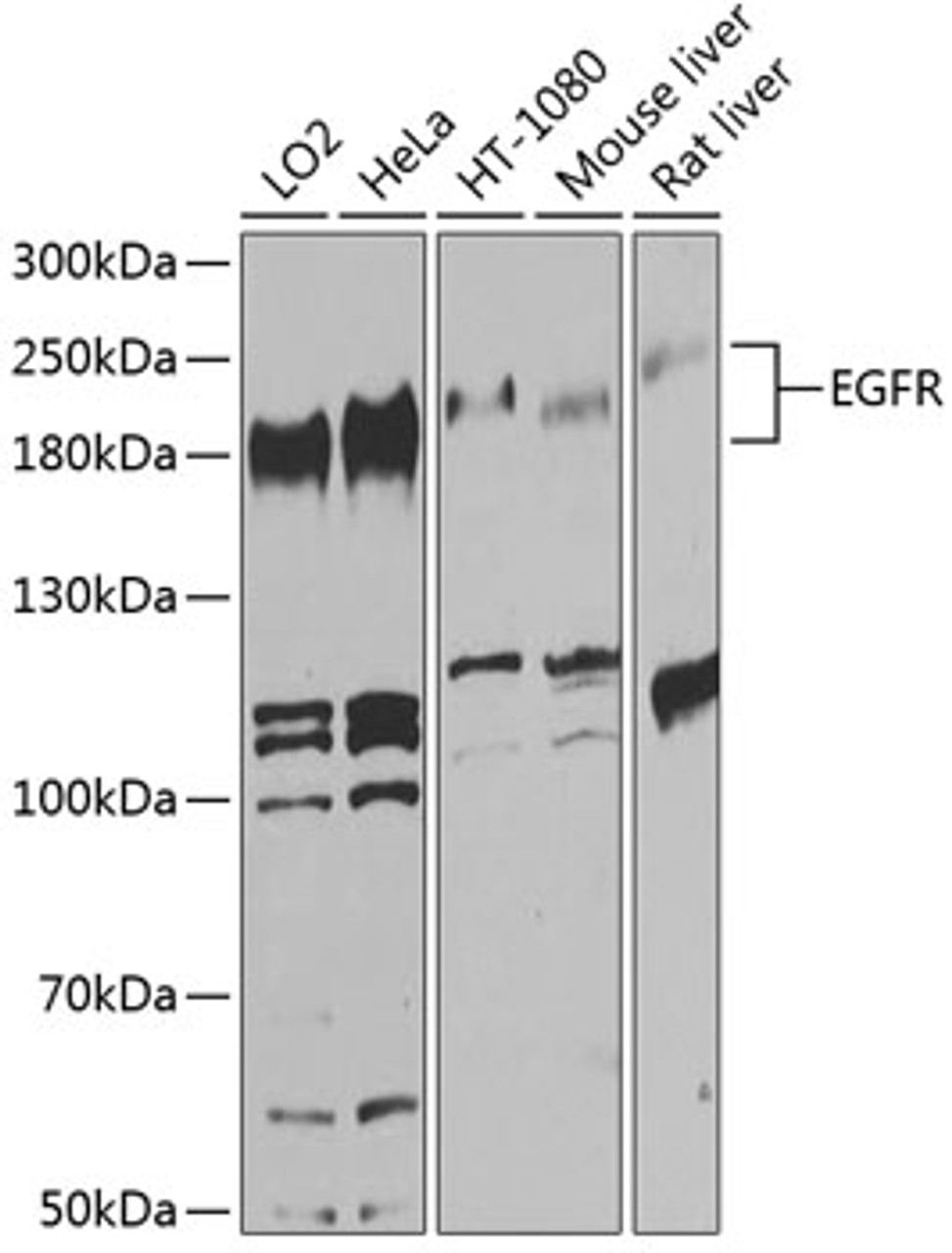 Western blot analysis of extracts of various cell lines, using EGFR antibody (14-053) at 1:1000 dilution.<br/>Secondary antibody: HRP Goat Anti-Rabbit IgG (H+L) at 1:10000 dilution.<br/>Lysates/proteins: 25ug per lane.<br/>Blocking buffer: 3% nonfat dry milk in TBST.<br/>Detection: ECL Basic Kit.<br/>Exposure time: 60s.