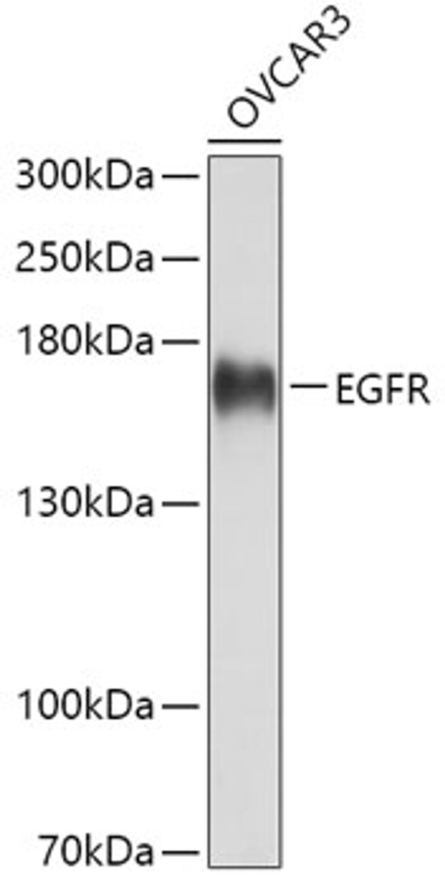 Western blot analysis of extracts of OVCAR3 cells, using EGFR antibody (14-055) at 1:3000 dilution.<br/>Secondary antibody: HRP Goat Anti-Rabbit IgG (H+L) at 1:10000 dilution.<br/>Lysates/proteins: 25ug per lane.<br/>Blocking buffer: 3% nonfat dry milk in TBST.<br/>Detection: ECL Basic Kit.<br/>Exposure time: 3s.