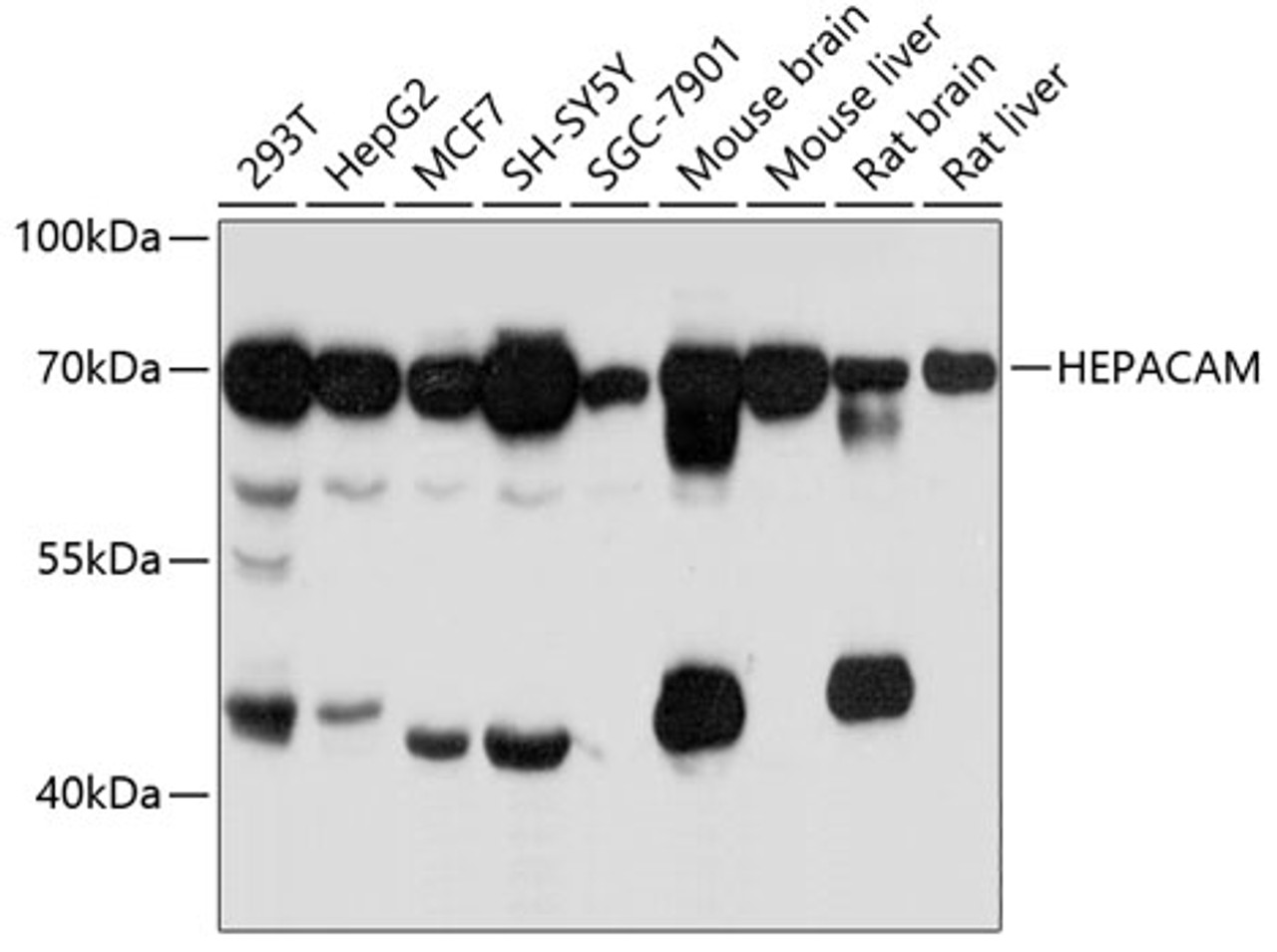 Western blot analysis of extracts of various cell lines, using HEPACAM antibody (14-057) at 1:3000 dilution.<br/>Secondary antibody: HRP Goat Anti-Rabbit IgG (H+L) at 1:10000 dilution.<br/>Lysates/proteins: 25ug per lane.<br/>Blocking buffer: 3% nonfat dry milk in TBST.<br/>Detection: ECL Basic Kit.<br/>Exposure time: 10s.