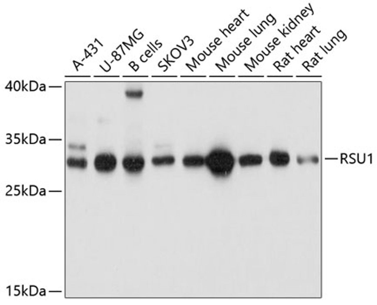 Western blot analysis of extracts of various cell lines, using RSU1 antibody (14-061) at 1:1000 dilution.<br/>Secondary antibody: HRP Goat Anti-Rabbit IgG (H+L) at 1:10000 dilution.<br/>Lysates/proteins: 25ug per lane.<br/>Blocking buffer: 3% nonfat dry milk in TBST.<br/>Detection: ECL Basic Kit.<br/>Exposure time: 5s.