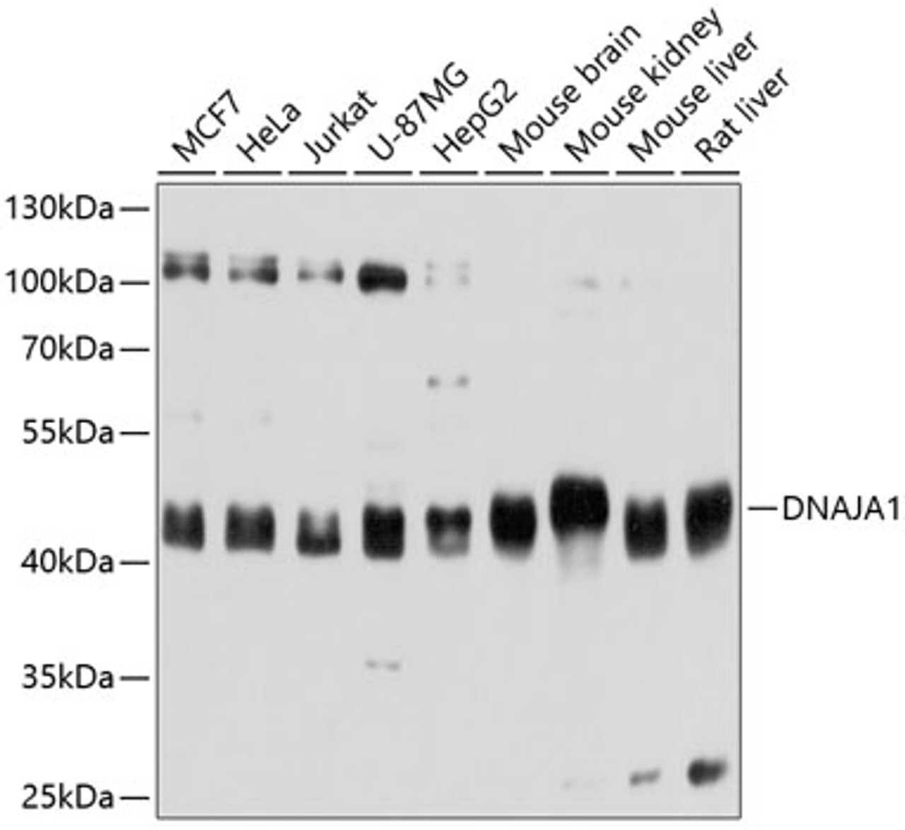 Western blot analysis of extracts of various cell lines, using DNAJA1 antibody (14-063) at 1:3000 dilution.<br/>Secondary antibody: HRP Goat Anti-Rabbit IgG (H+L) at 1:10000 dilution.<br/>Lysates/proteins: 25ug per lane.<br/>Blocking buffer: 3% nonfat dry milk in TBST.<br/>Detection: ECL Basic Kit.<br/>Exposure time: 1s.