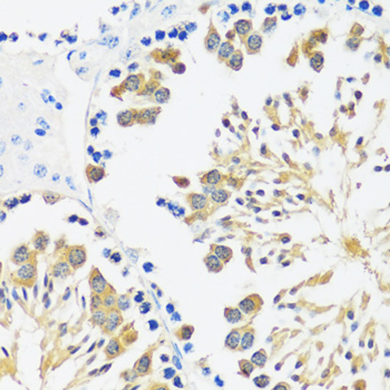 Immunohistochemistry of paraffin-embedded mouse testis using CALM3 antibody (14-065) at dilution of 1:100 (40x lens) .