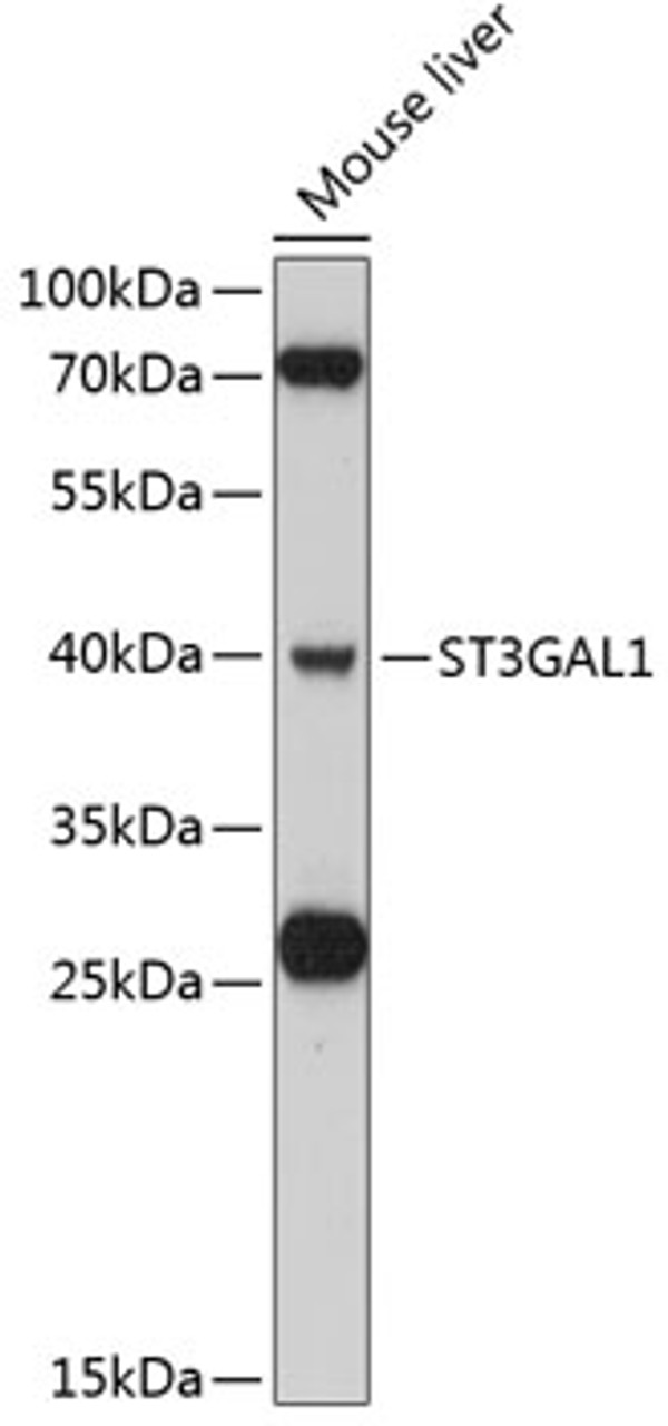 Western blot analysis of extracts of mouse liver, using ST3GAL1 antibody (14-067) at 1:3000 dilution.<br/>Secondary antibody: HRP Goat Anti-Rabbit IgG (H+L) at 1:10000 dilution.<br/>Lysates/proteins: 25ug per lane.<br/>Blocking buffer: 3% nonfat dry milk in TBST.<br/>Detection: ECL Basic Kit.<br/>Exposure time: 40s.