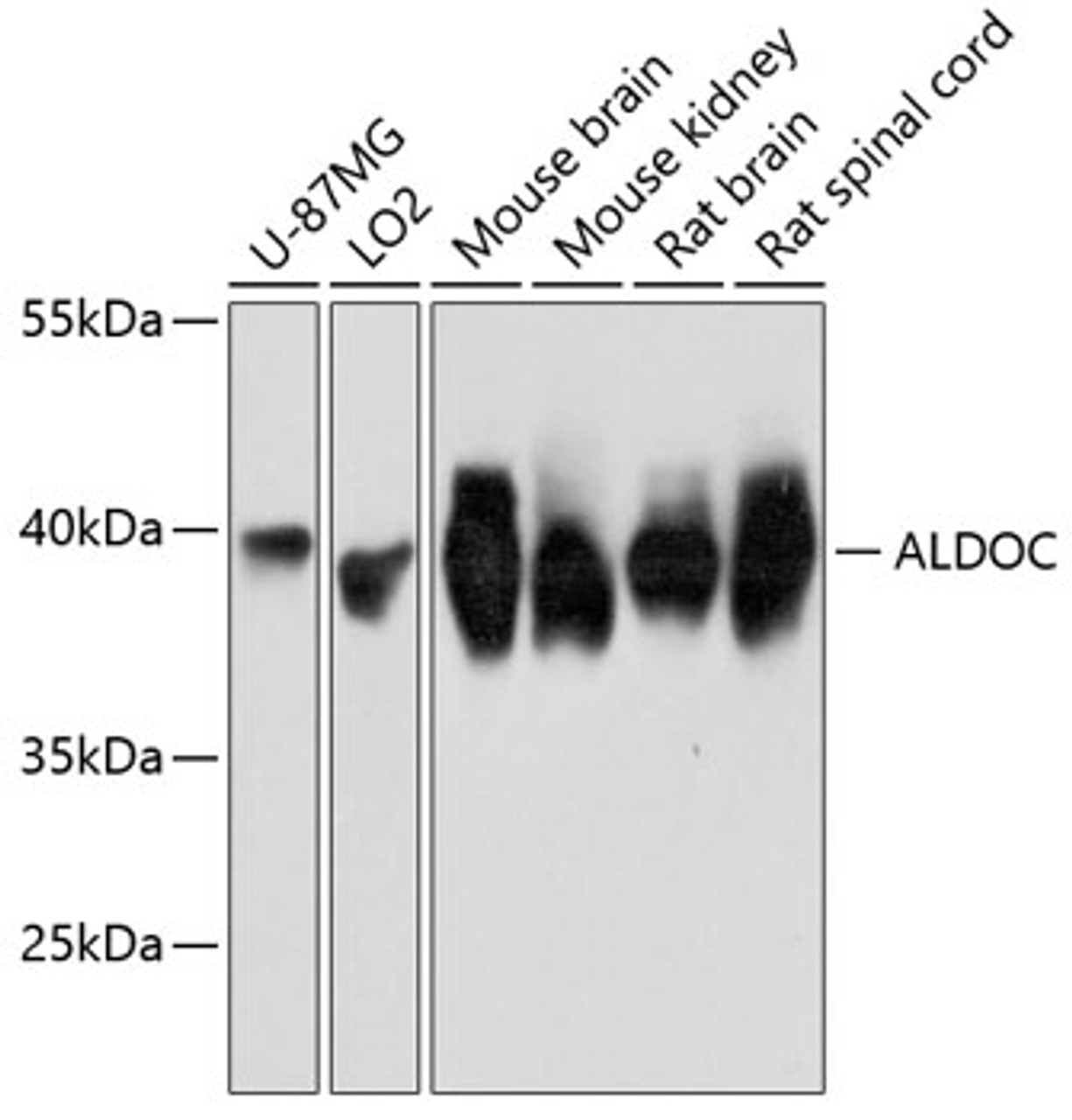 Western blot analysis of extracts of various cell lines, using ALDOC Antibody (14-068) at 1:3000 dilution.<br/>Secondary antibody: HRP Goat Anti-Rabbit IgG (H+L) at 1:10000 dilution.<br/>Lysates/proteins: 25ug per lane.<br/>Blocking buffer: 3% nonfat dry milk in TBST.<br/>Detection: ECL Basic Kit.<br/>Exposure time: 3s.