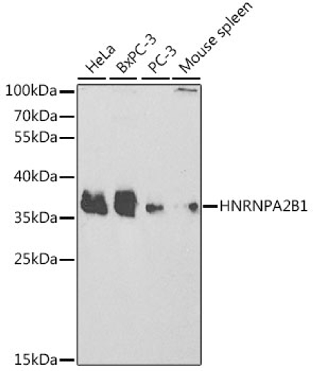 Western blot analysis of extracts of various cell lines, using HNRNPA2B1 antibody (14-069) at 1:1000 dilution.<br/>Secondary antibody: HRP Goat Anti-Rabbit IgG (H+L) at 1:10000 dilution.<br/>Lysates/proteins: 25ug per lane.<br/>Blocking buffer: 3% nonfat dry milk in TBST.