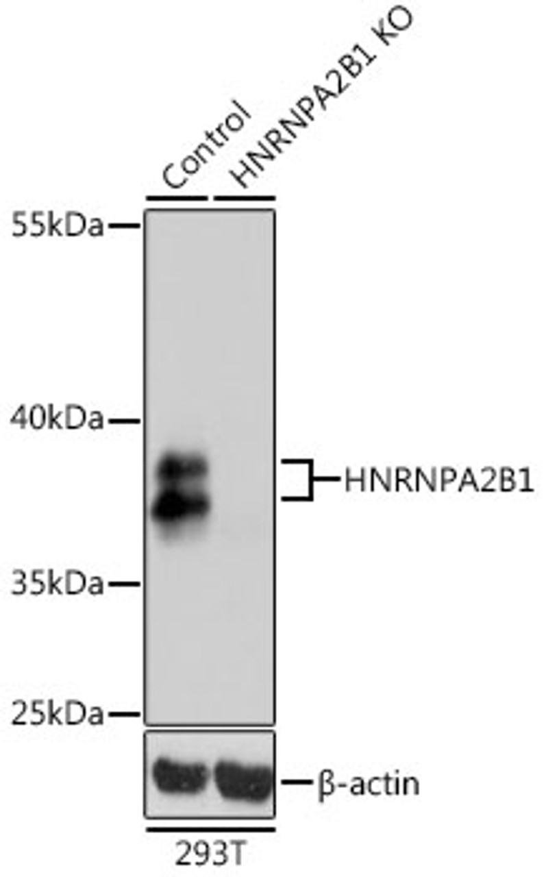 Western blot analysis of extracts from normal (control) and HNRNPA2B1 knockout (KO) 293T cells, using HNRNPA2B1 antibody (14-069) at 1:1000 dilution.<br/>Secondary antibody: HRP Goat Anti-Rabbit IgG (H+L) at 1:10000 dilution.<br/>Lysates/proteins: 25ug per lane.<br/>Blocking buffer: 3% nonfat dry milk in TBST.<br/>Detection: ECL Basic Kit.<br/>Exposure time: 1s.