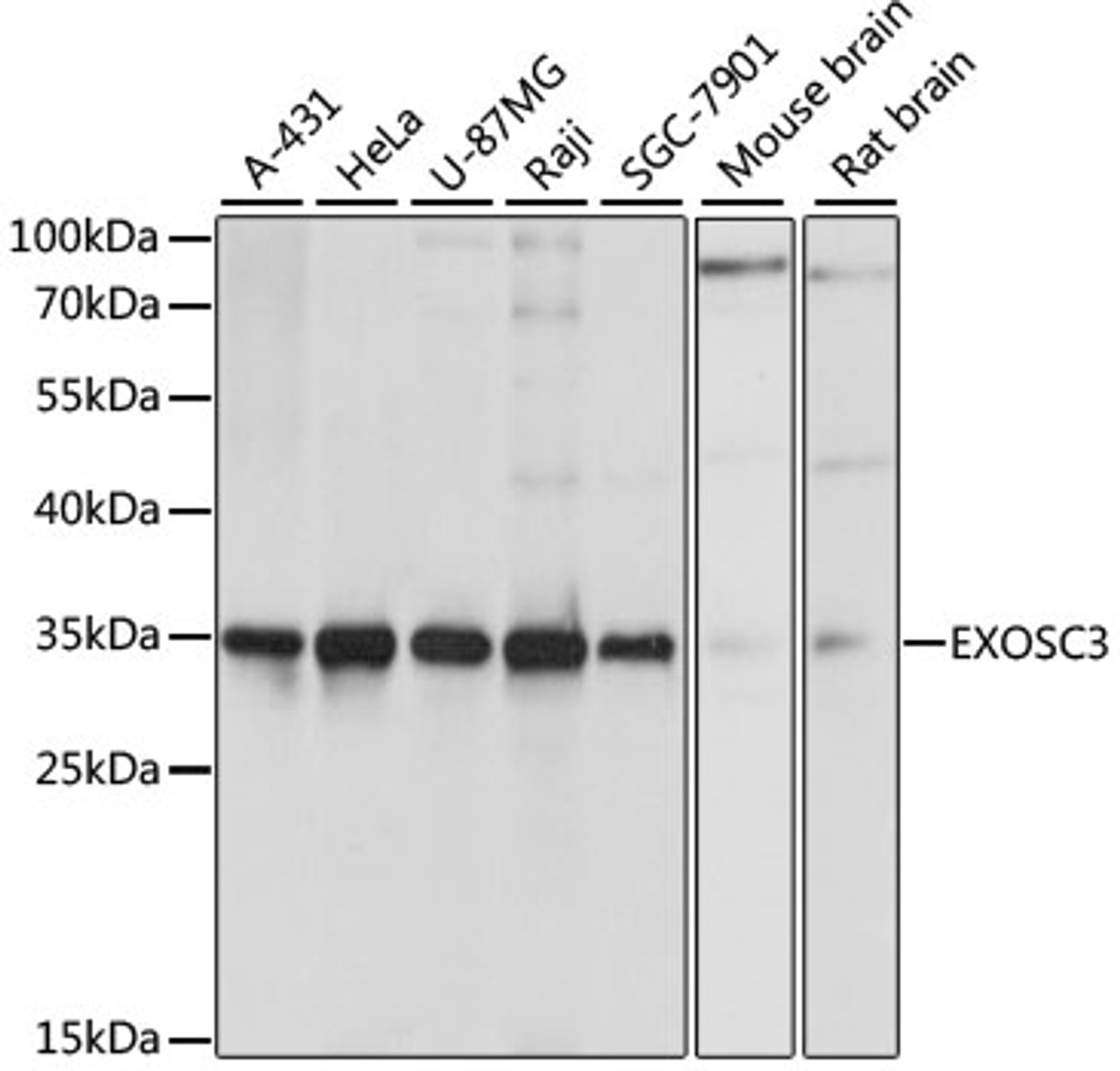 Western blot analysis of extracts of various cell lines, using EXOSC3 antibody (14-071) at 1:1000 dilution.<br/>Secondary antibody: HRP Goat Anti-Rabbit IgG (H+L) at 1:10000 dilution.<br/>Lysates/proteins: 25ug per lane.<br/>Blocking buffer: 3% nonfat dry milk in TBST.<br/>Detection: ECL Basic Kit.<br/>Exposure time: 1s.