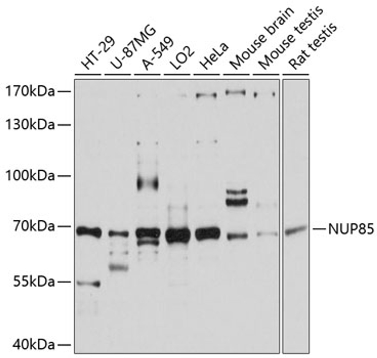 Western blot analysis of extracts of various cell lines, using NUP85 antibody (14-074) at 1:3000 dilution.<br/>Secondary antibody: HRP Goat Anti-Rabbit IgG (H+L) at 1:10000 dilution.<br/>Lysates/proteins: 25ug per lane.<br/>Blocking buffer: 3% nonfat dry milk in TBST.<br/>Detection: ECL Basic Kit.<br/>Exposure time: 10s.