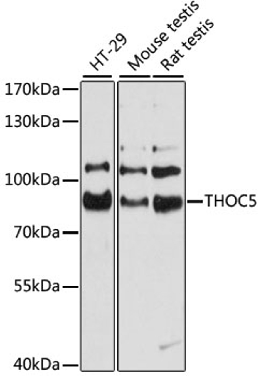 Western blot analysis of extracts of various cell lines, using THOC5 antibody (14-078) at 1:3000 dilution.<br/>Secondary antibody: HRP Goat Anti-Rabbit IgG (H+L) at 1:10000 dilution.<br/>Lysates/proteins: 25ug per lane.<br/>Blocking buffer: 3% nonfat dry milk in TBST.<br/>Detection: ECL Basic Kit.<br/>Exposure time: 10s.