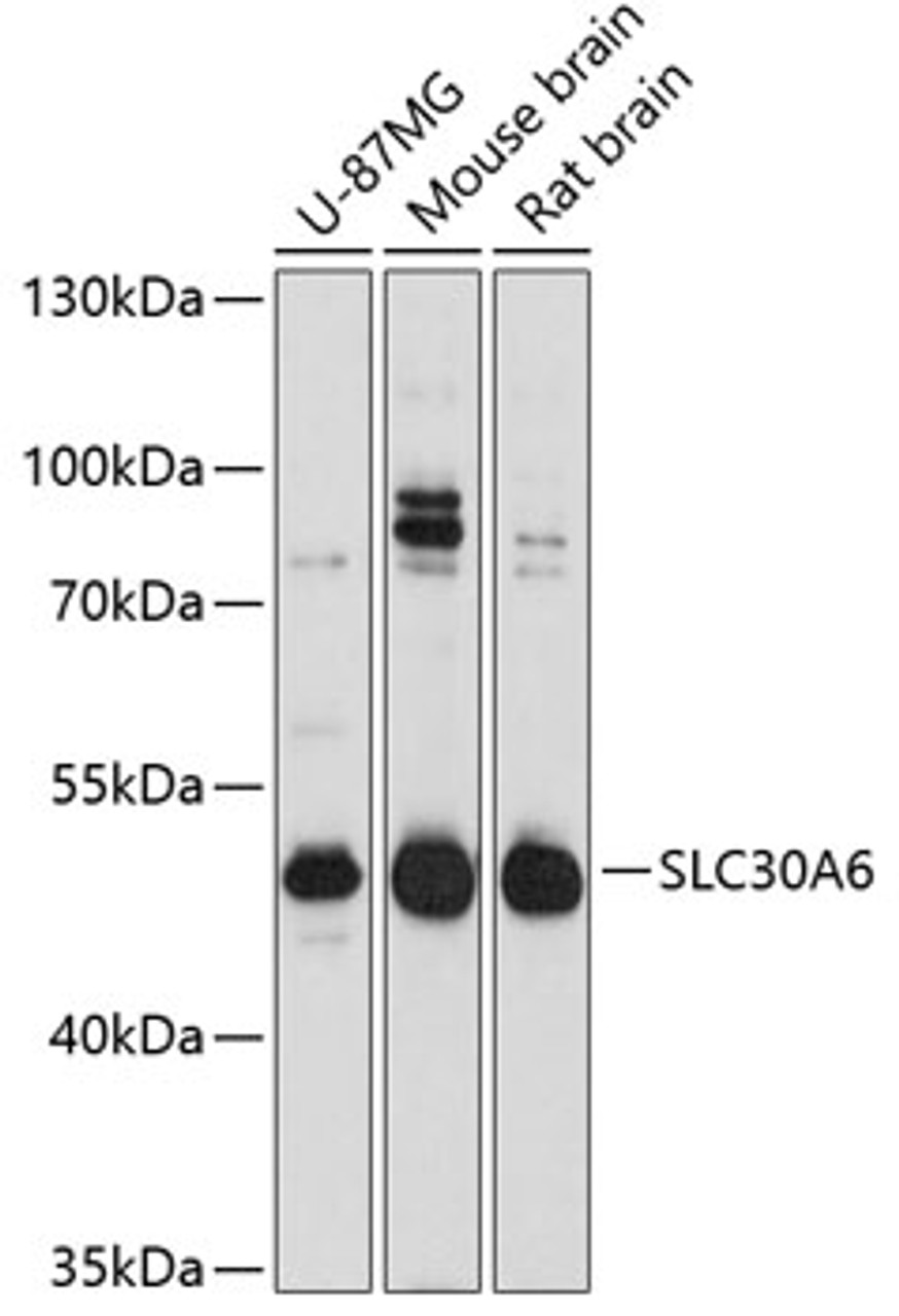 Western blot analysis of extracts of various cell lines, using SLC30A6 Antibody (14-081) at 1:3000 dilution.<br/>Secondary antibody: HRP Goat Anti-Rabbit IgG (H+L) at 1:10000 dilution.<br/>Lysates/proteins: 25ug per lane.<br/>Blocking buffer: 3% nonfat dry milk in TBST.<br/>Detection: ECL Basic Kit.<br/>Exposure time: 30s.