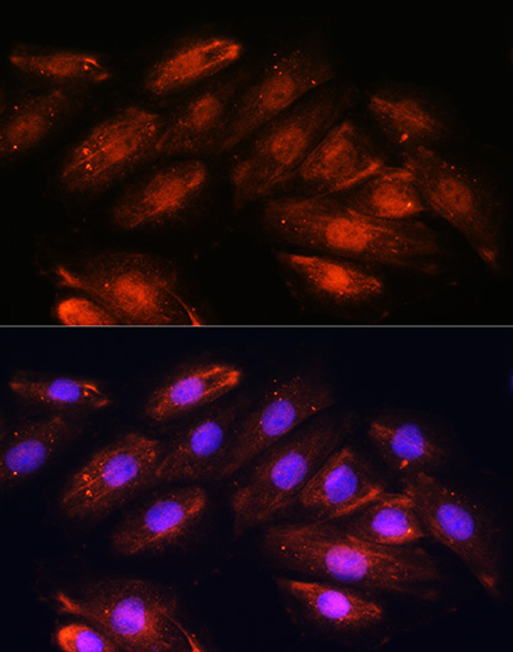 Immunofluorescence analysis of H9C2 cells using OTUB1 antibody (14-086) at dilution of 1:100. Blue: DAPI for nuclear staining.