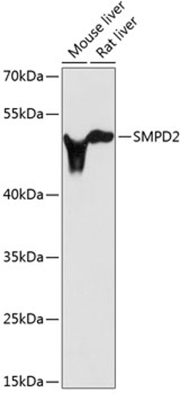Western blot analysis of extracts of various cell lines, using SMPD2 antibody (14-088) at 1:3000 dilution.<br/>Secondary antibody: HRP Goat Anti-Rabbit IgG (H+L) at 1:10000 dilution.<br/>Lysates/proteins: 25ug per lane.<br/>Blocking buffer: 3% nonfat dry milk in TBST.<br/>Detection: ECL Basic Kit.<br/>Exposure time: 90s.