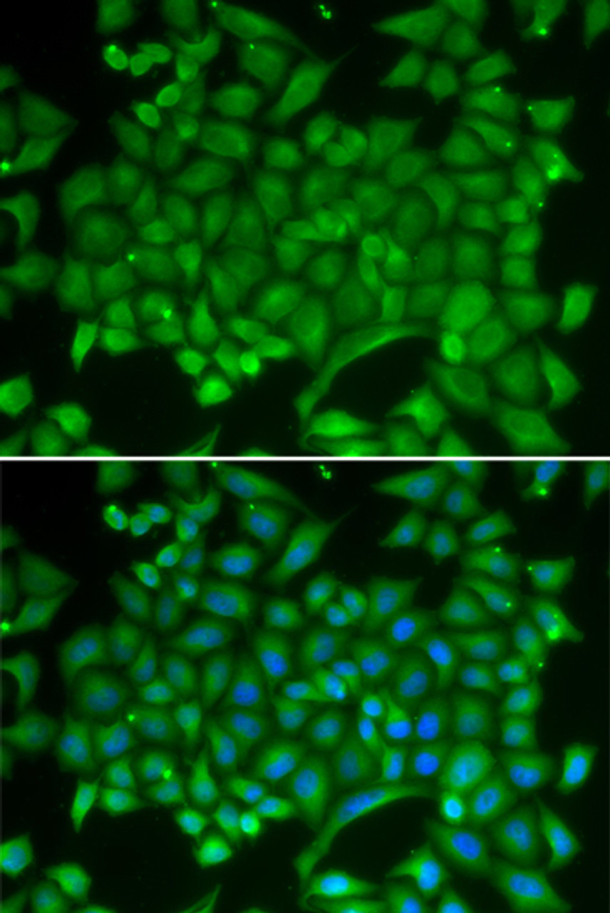 Immunofluorescence analysis of MCF-7 cells using RAB11A antibody (14-092) . Blue: DAPI for nuclear staining.