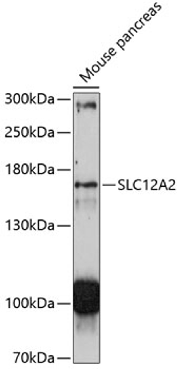 Western blot analysis of extracts of mouse pancreas, using SLC12A2 antibody (14-095) at 1:3000 dilution.<br/>Secondary antibody: HRP Goat Anti-Rabbit IgG (H+L) at 1:10000 dilution.<br/>Lysates/proteins: 25ug per lane.<br/>Blocking buffer: 3% nonfat dry milk in TBST.<br/>Detection: ECL Enhanced Kit.<br/>Exposure time: 90s.
