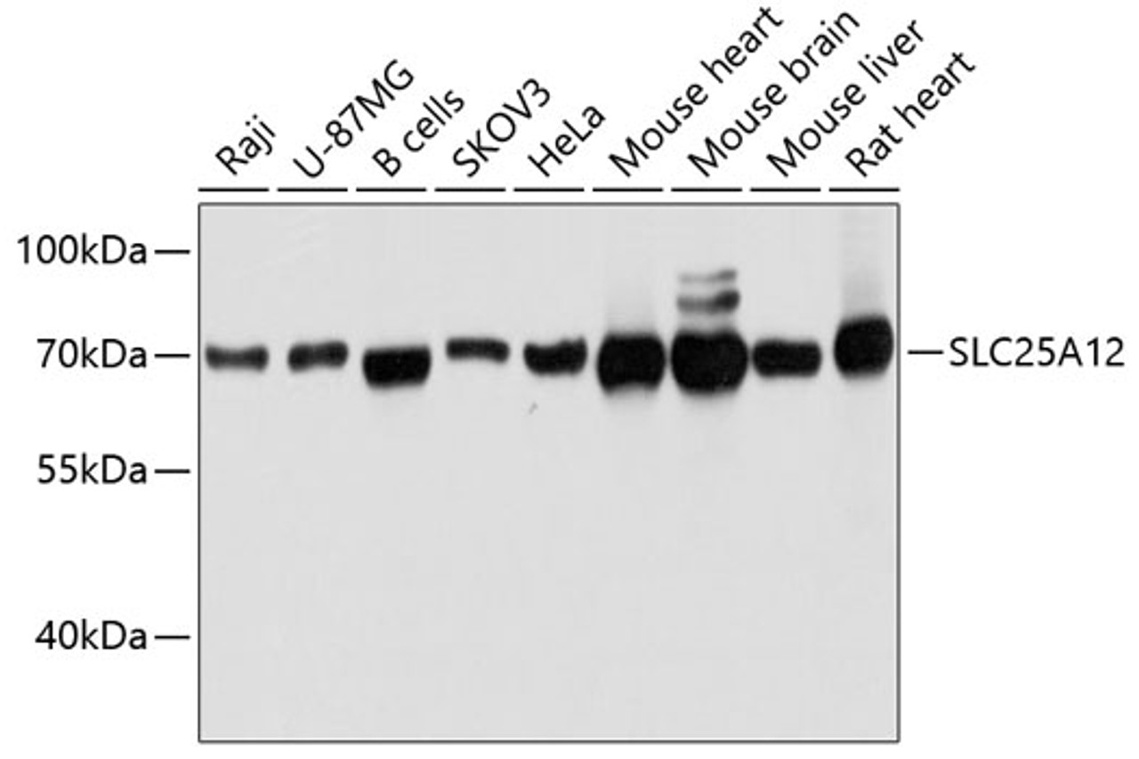 Western blot analysis of extracts of various cell lines, using SLC25A12 antibody (14-101) at 1:3000 dilution.<br/>Secondary antibody: HRP Goat Anti-Rabbit IgG (H+L) at 1:10000 dilution.<br/>Lysates/proteins: 25ug per lane.<br/>Blocking buffer: 3% nonfat dry milk in TBST.<br/>Detection: ECL Basic Kit.<br/>Exposure time: 1s.