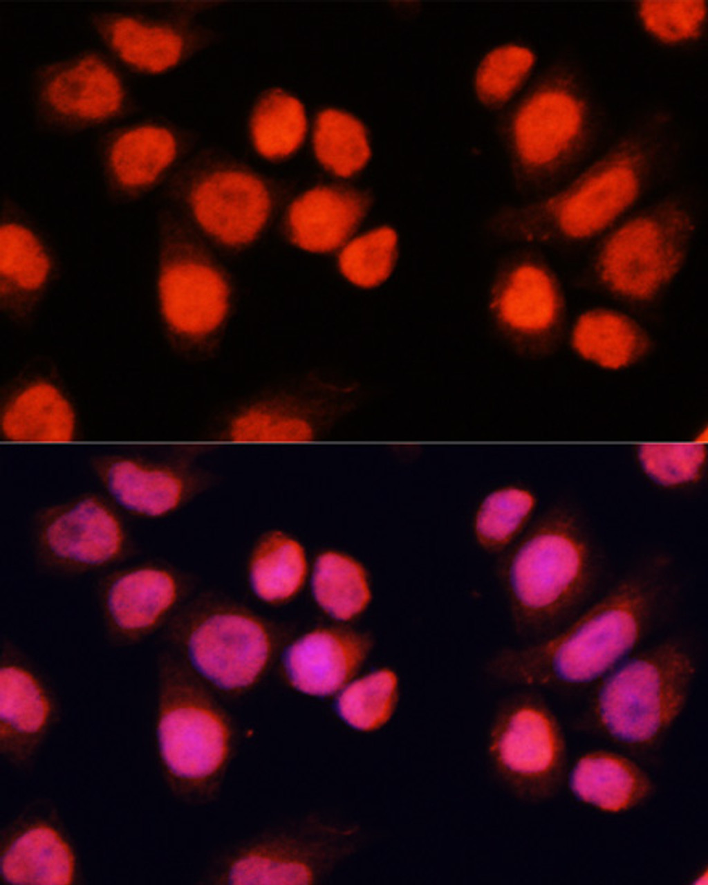 Immunofluorescence analysis of Hela cells using CHAMP1 antibody (14-102) at dilution of 1:100 (40x lens) . Blue: DAPI for nuclear staining.