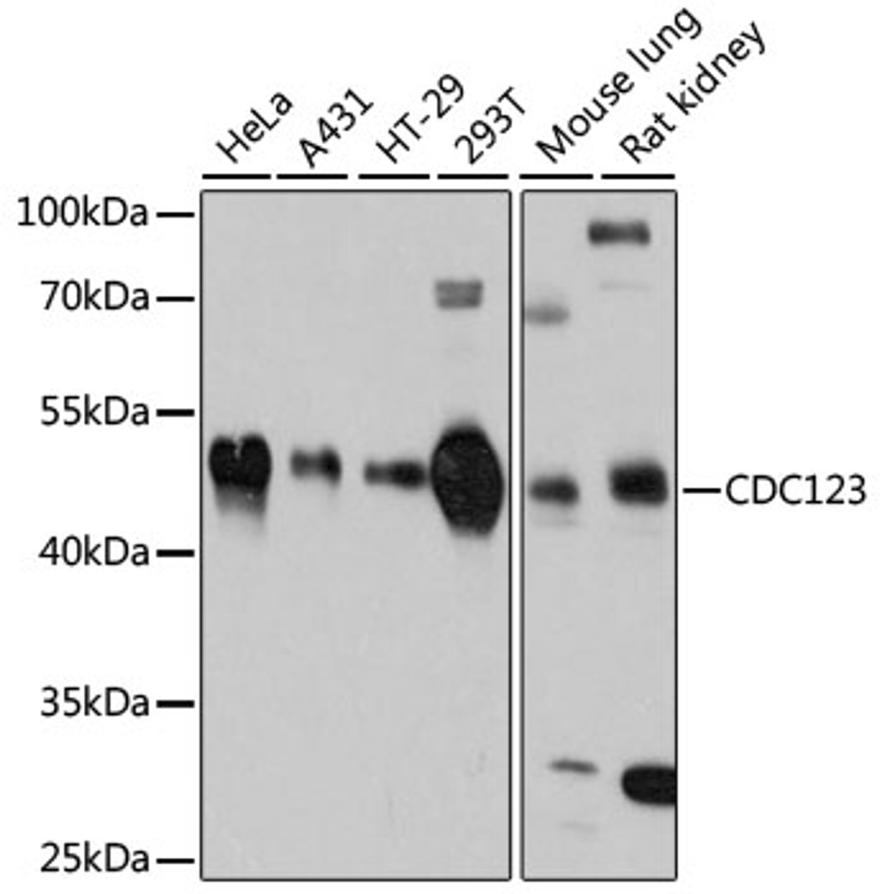 Western blot analysis of extracts of various cell lines, using CDC123 antibody (14-104) at 1:3000 dilution.<br/>Secondary antibody: HRP Goat Anti-Rabbit IgG (H+L) at 1:10000 dilution.<br/>Lysates/proteins: 25ug per lane.<br/>Blocking buffer: 3% nonfat dry milk in TBST.<br/>Detection: ECL Basic Kit.<br/>Exposure time: 10s.