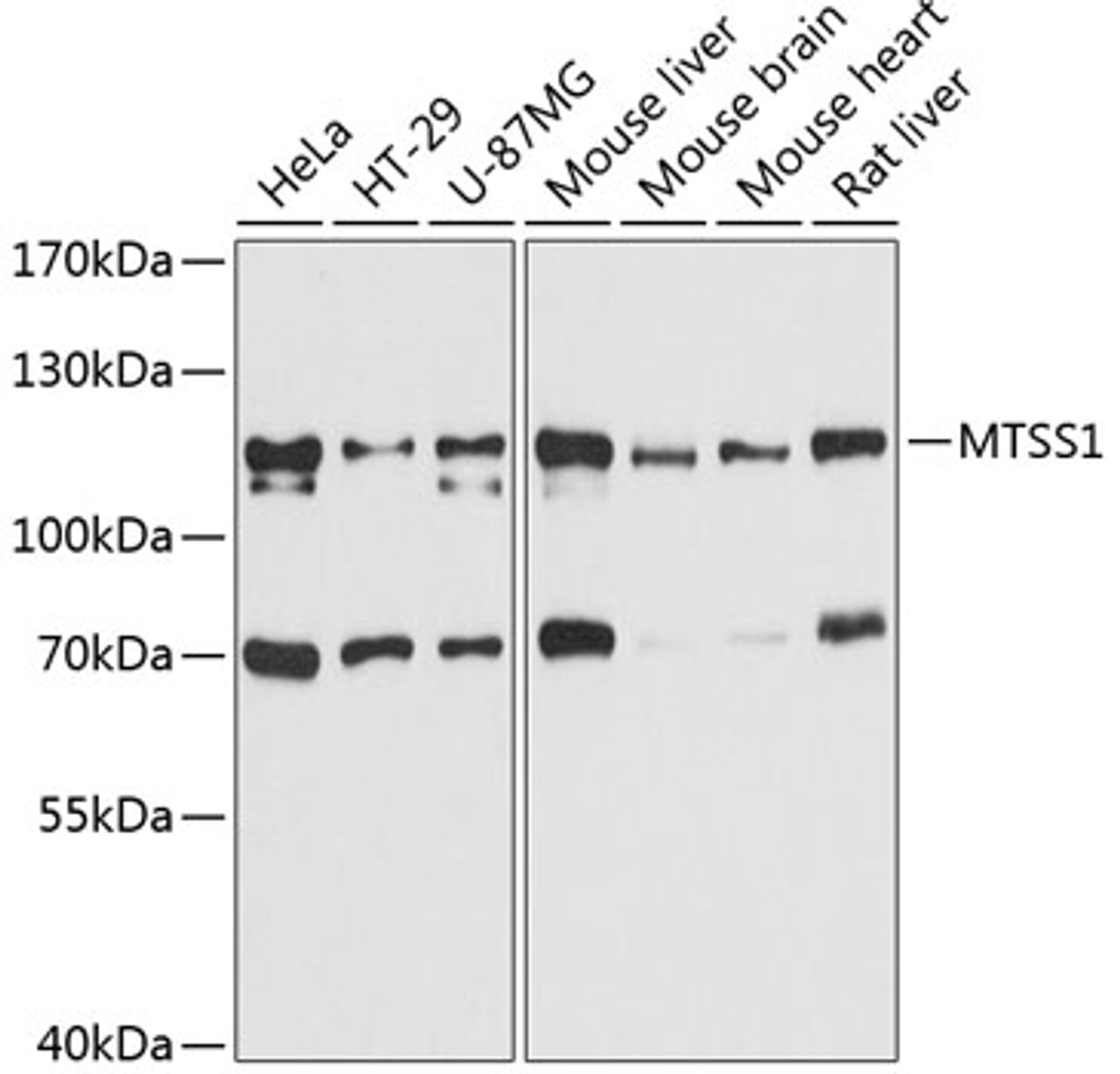 Western blot analysis of extracts of various cell lines, using MTSS1 antibody (14-105) at 1:3000 dilution.<br/>Secondary antibody: HRP Goat Anti-Rabbit IgG (H+L) at 1:10000 dilution.<br/>Lysates/proteins: 25ug per lane.<br/>Blocking buffer: 3% nonfat dry milk in TBST.<br/>Detection: ECL Basic Kit.<br/>Exposure time: 10s.