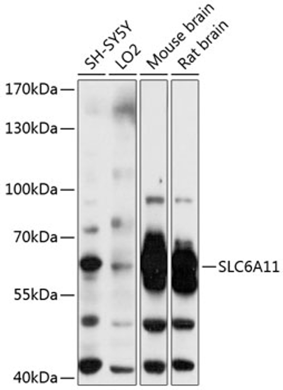 Western blot analysis of extracts of various cell lines, using SLC6A11 antibody (14-106) at 1:3000 dilution.<br/>Secondary antibody: HRP Goat Anti-Rabbit IgG (H+L) at 1:10000 dilution.<br/>Lysates/proteins: 25ug per lane.<br/>Blocking buffer: 3% nonfat dry milk in TBST.<br/>Detection: ECL Basic Kit.<br/>Exposure time: 5s.