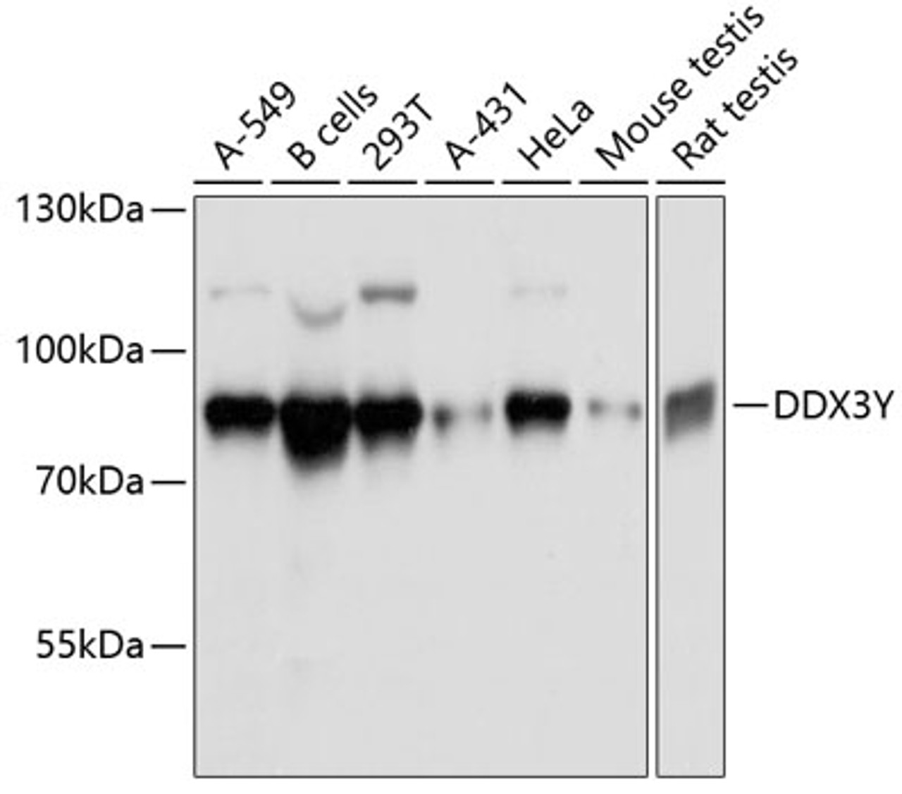 Western blot analysis of extracts of various cell lines, using DDX3Y antibody (14-107) at 1:3000 dilution.<br/>Secondary antibody: HRP Goat Anti-Rabbit IgG (H+L) at 1:10000 dilution.<br/>Lysates/proteins: 25ug per lane.<br/>Blocking buffer: 3% nonfat dry milk in TBST.<br/>Detection: ECL Basic Kit.<br/>Exposure time: 1s.