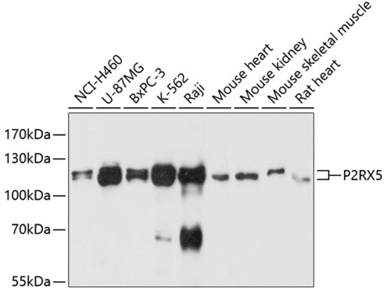 Western blot analysis of extracts of various cell lines, using P2RX5 antibody (14-110) at 1:3000 dilution.<br/>Secondary antibody: HRP Goat Anti-Rabbit IgG (H+L) at 1:10000 dilution.<br/>Lysates/proteins: 25ug per lane.<br/>Blocking buffer: 3% nonfat dry milk in TBST.<br/>Detection: ECL Basic Kit.<br/>Exposure time: 10s.