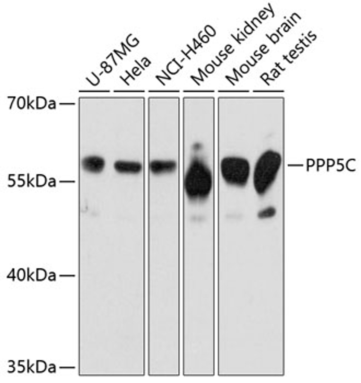 Western blot analysis of extracts of various cell lines, using PPP5C Antibody (14-112) at 1:3000 dilution.<br/>Secondary antibody: HRP Goat Anti-Rabbit IgG (H+L) at 1:10000 dilution.<br/>Lysates/proteins: 25ug per lane.<br/>Blocking buffer: 3% nonfat dry milk in TBST.<br/>Detection: ECL Basic Kit.<br/>Exposure time: 60s.