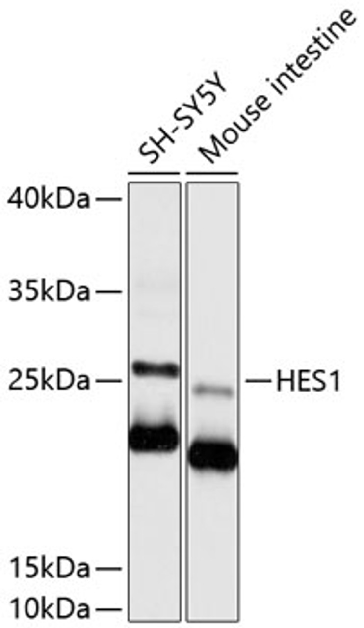 Western blot analysis of extracts of various cell lines, using HES1 antibody (14-116) at 1:1000 dilution.<br/>Secondary antibody: HRP Goat Anti-Rabbit IgG (H+L) at 1:10000 dilution.<br/>Lysates/proteins: 25ug per lane.<br/>Blocking buffer: 3% nonfat dry milk in TBST.<br/>Detection: ECL Basic Kit.<br/>Exposure time: 15s.